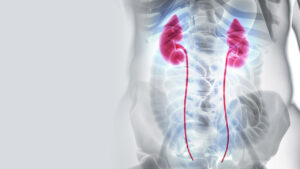 Estenosis Uretral