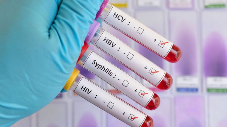 Enfermedades de transmisión sexual