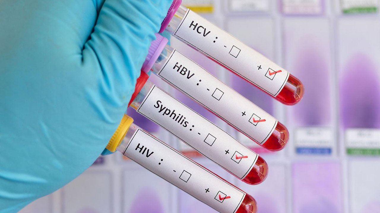 Enfermedades de transmisión sexual