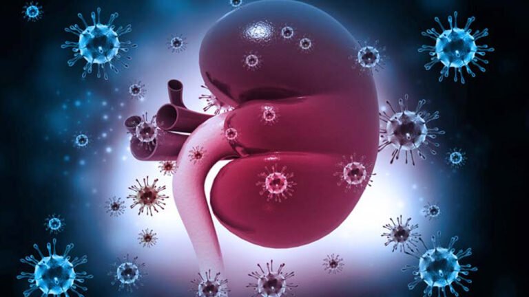 Pielonefritis, síntomas y tratamiento