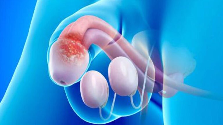 Funciones y enfermedades del Testículo